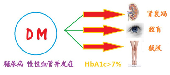 手术已成为2型糖尿病新的有效治疗方法