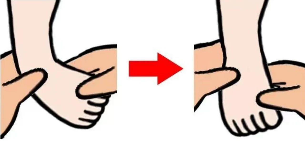 马蹄足内翻：你需要了解的病因、症状与治疗